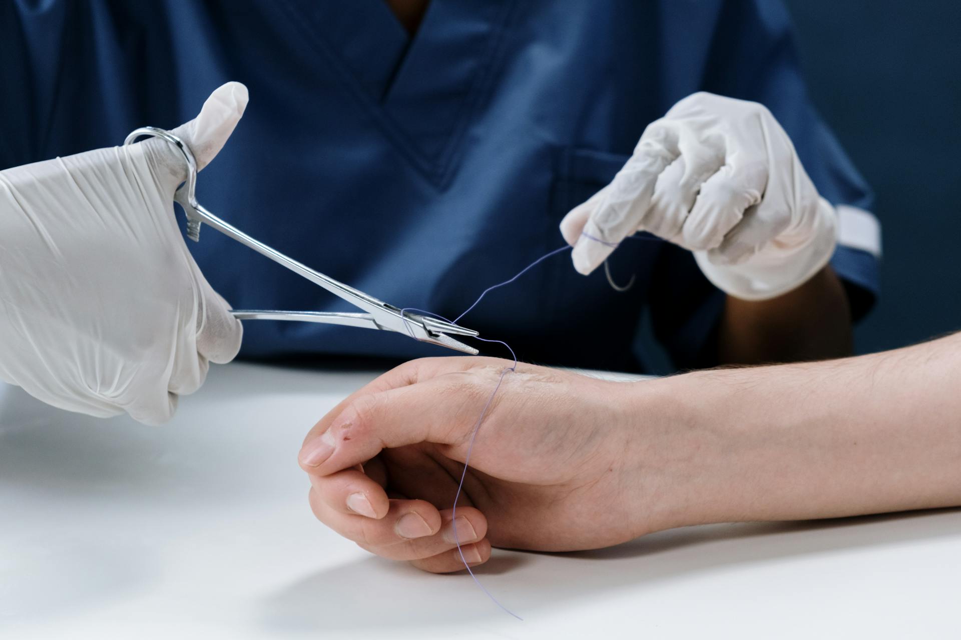 sutures